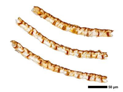 fuscocephaloziopsis 1 lunulifolia kapsel quer