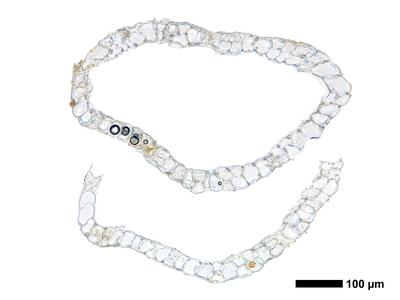 fuscocephaloziopsis 1 lunulifolia perianth basis quer