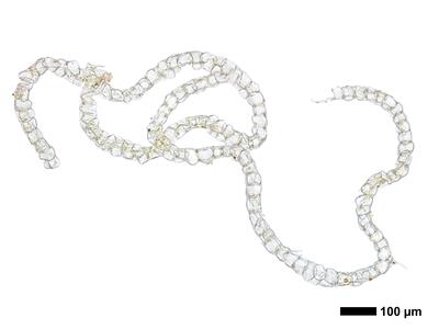 fuscocephaloziopsis 1 lunulifolia perianth mitte quer