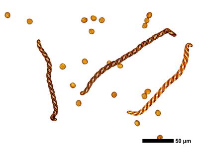 fuscocephaloziopsis 1 lunulifolia sporen elateren