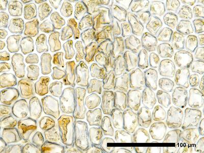 fuscocephaloziopsis albescens 1 flankenblatt zellen