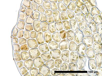 fuscocephaloziopsis albescens 1 flankenblatt zellen blattrand