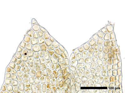 fuscocephaloziopsis albescens 1 flankenblatt zellen blattspitze