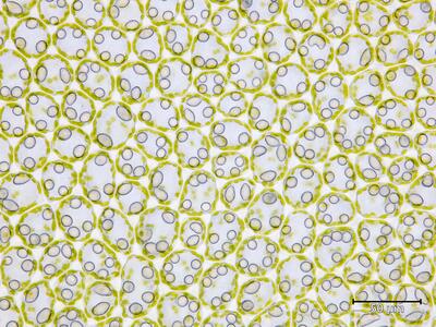 fuscocephaloziopsis albescens flankenblatt blattmitte