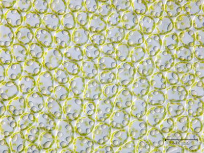 fuscocephaloziopsis albescens flankenblatt blattmitte dic