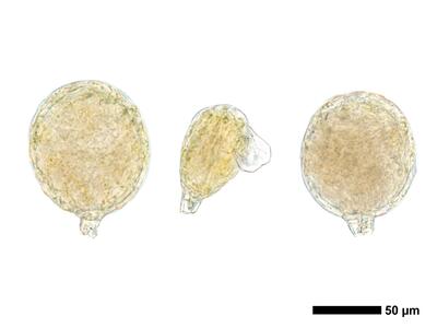 fuscocephaloziopsis leucantha 1 antheridien
