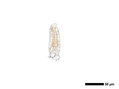 fuscocephaloziopsis leucantha 1 archegonium