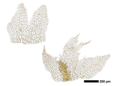 fuscocephaloziopsis leucantha 1 female bract