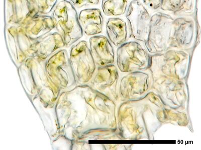 fuscocephaloziopsis leucantha 1 flankenblatt blattbasis