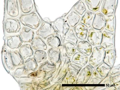 fuscocephaloziopsis leucantha 1 flankenblatt blattmitte