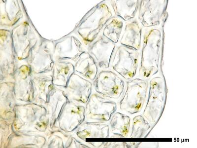 fuscocephaloziopsis leucantha 1 flankenblatt blattrand