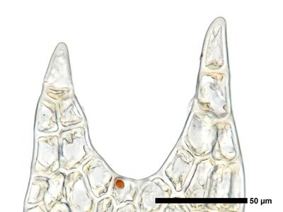 fuscocephaloziopsis leucantha 1 flankenblatt blattspitze