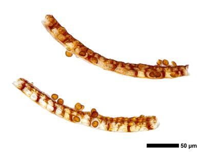 fuscocephaloziopsis leucantha 1 kapsel quer