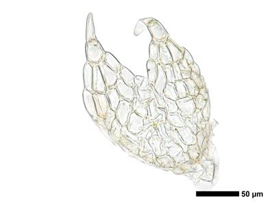 fuscocephaloziopsis leucantha 1 male bract