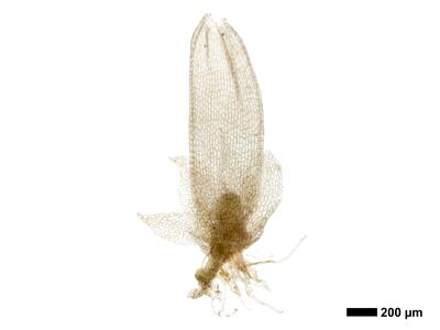 fuscocephaloziopsis leucantha 1 perianth