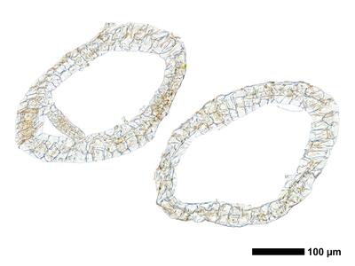 fuscocephaloziopsis leucantha 1 perianth basis quer