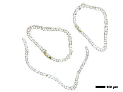 fuscocephaloziopsis leucantha 1 perianth mitte quer