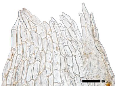 fuscocephaloziopsis leucantha 1 perianthmuendung