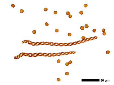 fuscocephaloziopsis leucantha 1 sporen elateren