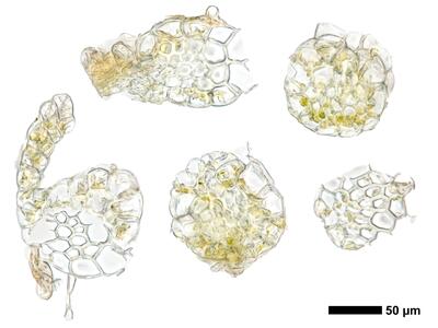 fuscocephaloziopsis leucantha 1 stamm quer