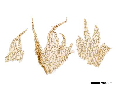 fuscocephaloziopsis loitlesbergeri 1 female bracts