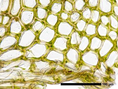 fuscocephaloziopsis loitlesbergeri 1 flankenblatt blattbasis