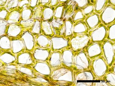 fuscocephaloziopsis loitlesbergeri 1 flankenblatt blattmitte