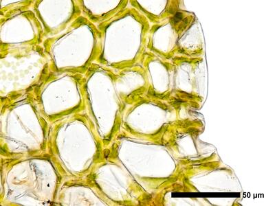 fuscocephaloziopsis loitlesbergeri 1 flankenblatt blattrand