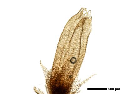 fuscocephaloziopsis loitlesbergeri 1 perianth
