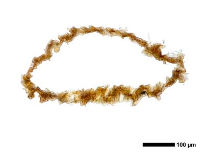 fuscocephaloziopsis loitlesbergeri 1 perianth basis quer