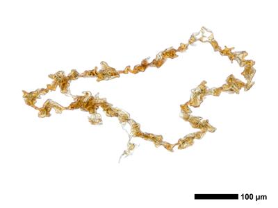 fuscocephaloziopsis loitlesbergeri 1 perianth mitte quer