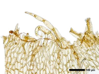 fuscocephaloziopsis loitlesbergeri 1 perianthmuendung