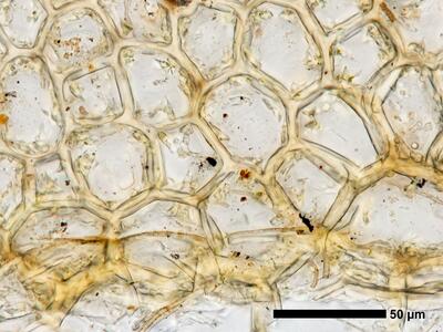 fuscocephaloziopsis macrostachya flankenblatt blattbasis