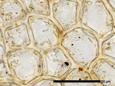 fuscocephaloziopsis macrostachya flankenblatt blattmitte