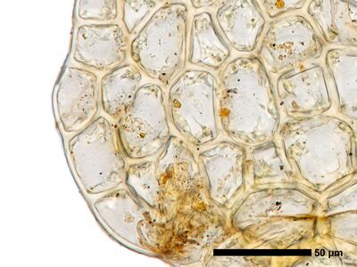 fuscocephaloziopsis macrostachya flankenblatt blattrand