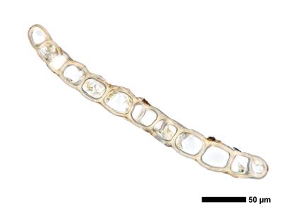 fuscocephaloziopsis macrostachya flankenblatt quer