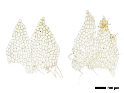 fuscocephaloziopsis pleniceps 1 female bracts