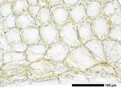 fuscocephaloziopsis pleniceps 1 flankenblatt blattbasis