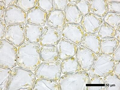 fuscocephaloziopsis pleniceps 1 flankenblatt blattmitte