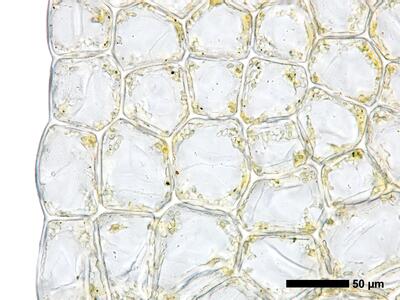 fuscocephaloziopsis pleniceps 1 flankenblatt blattrand