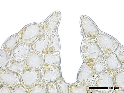 fuscocephaloziopsis pleniceps 1 flankenblatt blattspitze