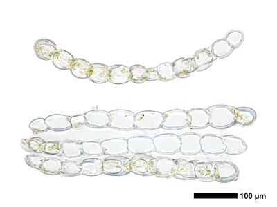 fuscocephaloziopsis pleniceps 1 flankenblatt quer