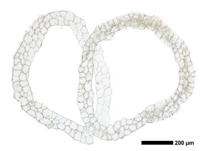 fuscocephaloziopsis pleniceps 1 perianth basis quer