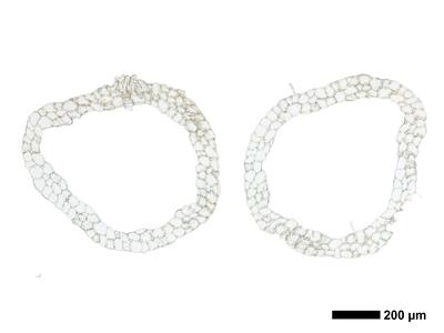 fuscocephaloziopsis pleniceps 1 perianth mitte quer