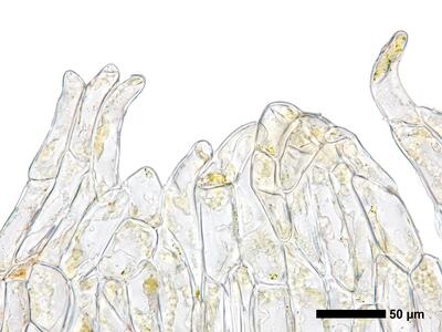 fuscocephaloziopsis pleniceps 1 perianthmuendung