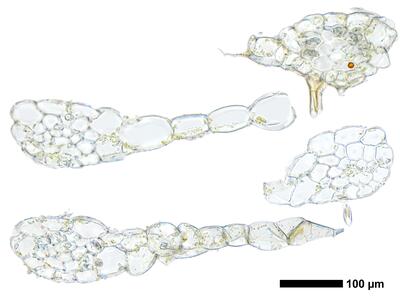 fuscocephaloziopsis pleniceps 1 stamm quer