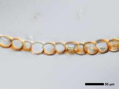 odontoschisma fluitans 1 flankenblatt quer detail