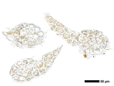 odontoschisma francisci 1 stamm quer