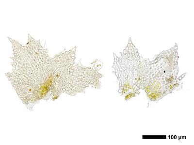 cephaloziella aspericaulis 1 female bract ring