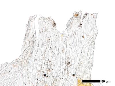 cephaloziella elegans perianthmuendung